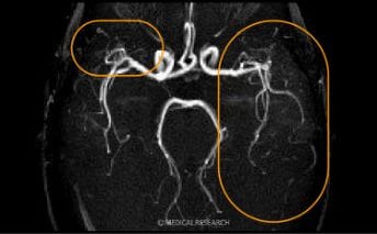 1.5T（テスラ）診断画像