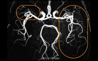 3.0T（テスラ）診断画像