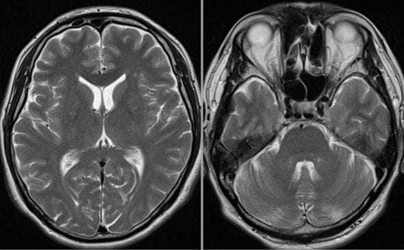 没後、複数の遺言の有効性が争われた事例